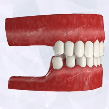Причины потери жевательных зубов